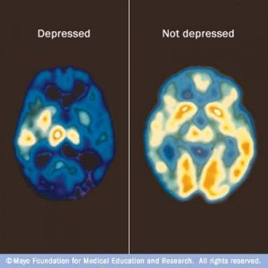 http://www.valleyhealth.com/images/image_popup/c7_pet_depression.jpg